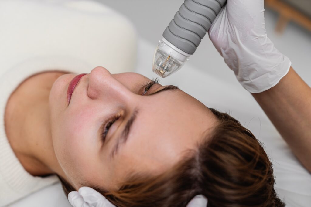 Microneedle RF lifting procedure. Hardware cosmetology.